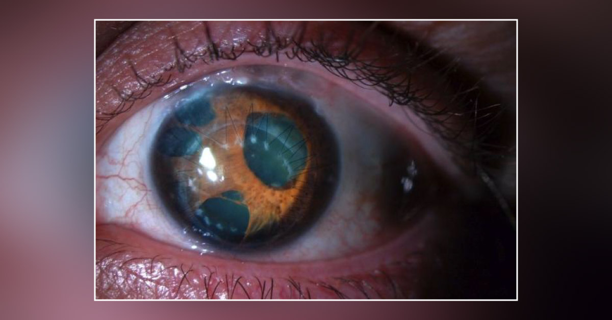 Brief Scenario On Effects Of Blunt Trauma
