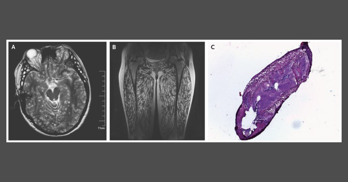 Can You Spot the Abnormality?