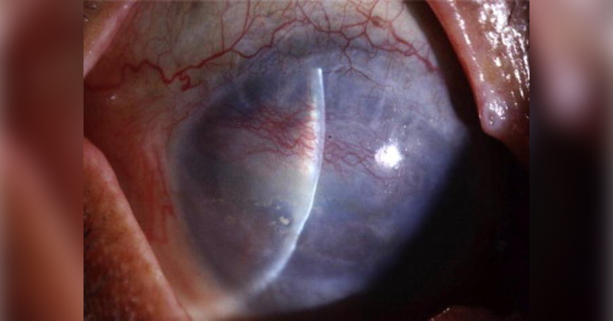 Spot The Diagnosis