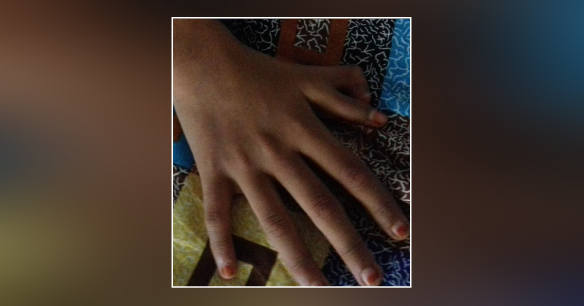 Dilemma Following ASD Closure