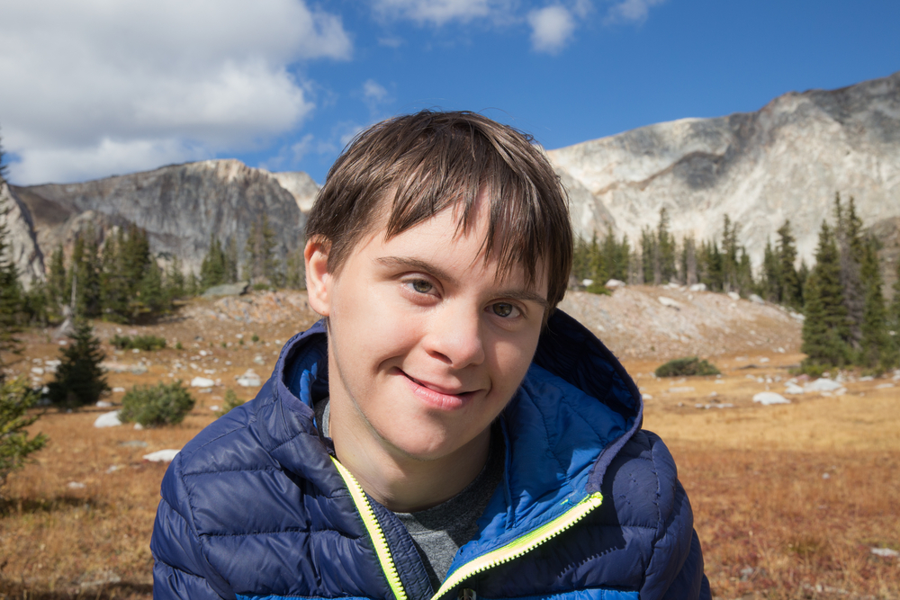 Ocular Manifestations Of Down's Syndrome