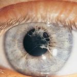 Diagnose The Ophthalmic Condition