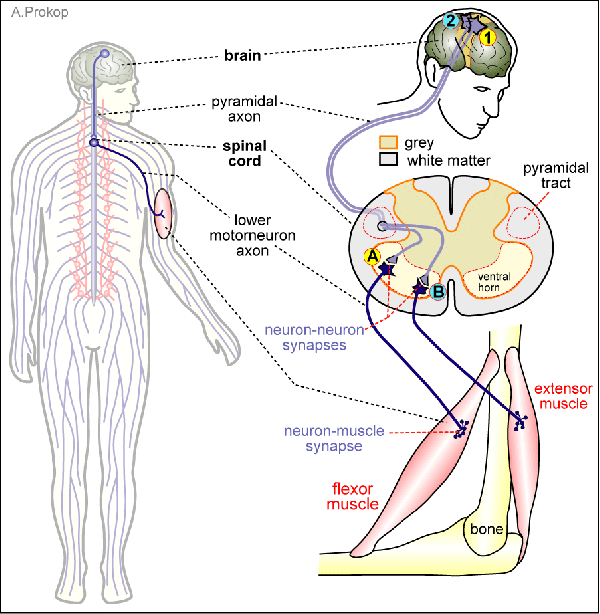 An-aged Lady With Walking Difficulty (Mini CPC)