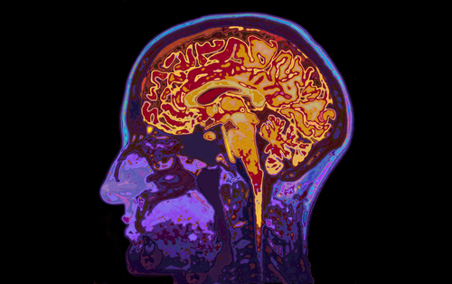 Brief Review On Propofol And CNS