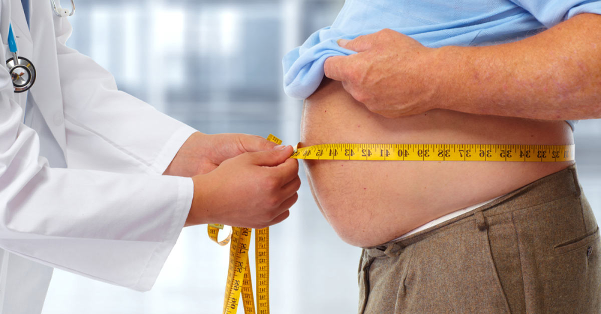 Suggest A Surgical Procedure For A Man With Obesity