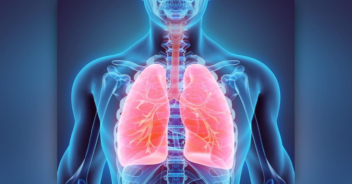 Value Of Positive End Expiratory Pressure In Ventilation