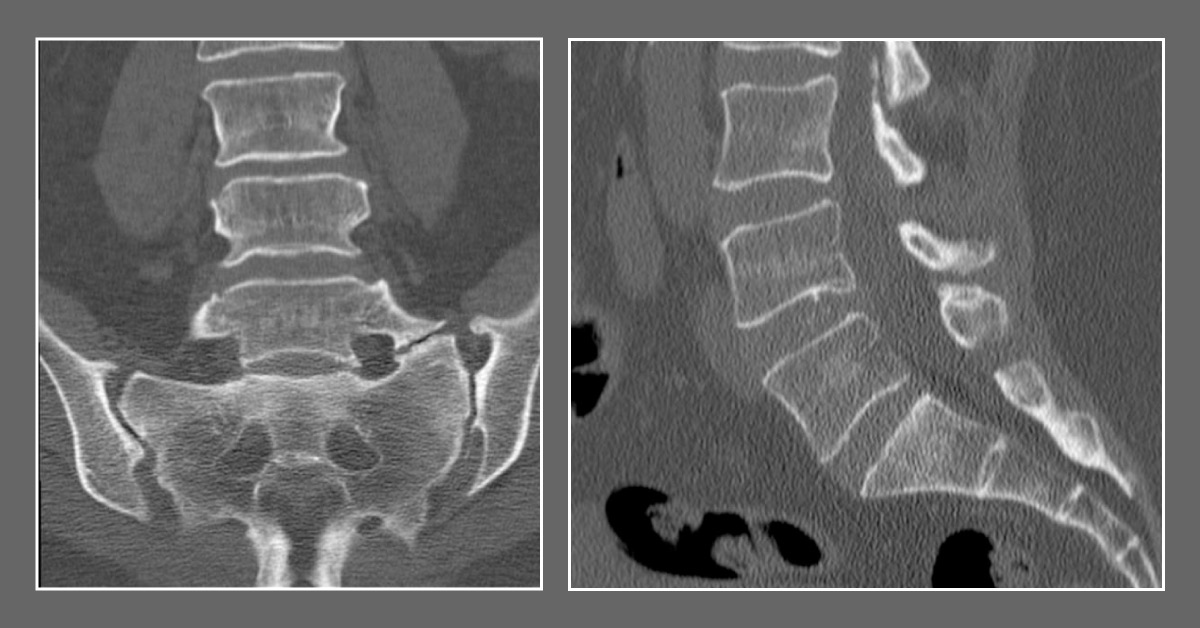 Diagnose This Case