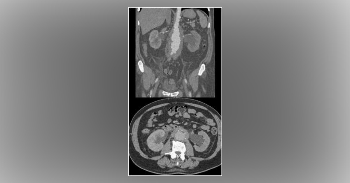 Diagnose The Urology Case?