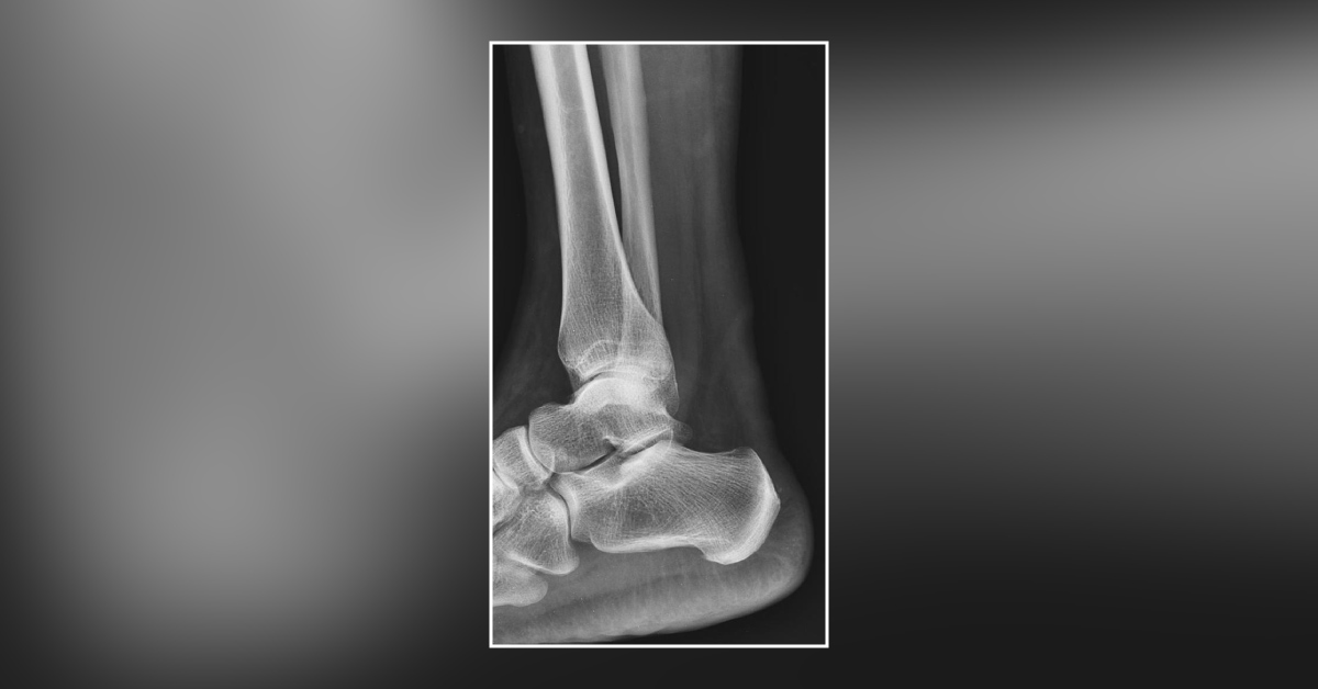 Image-based Diagnosis of the Condition