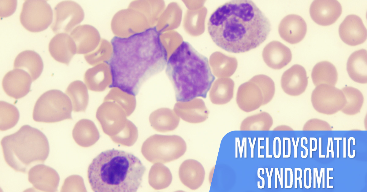 Myelodysplastic Syndromes: Frequently Asked Questions