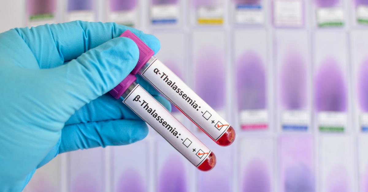 Thalassaemia: Frequently Asked Questions