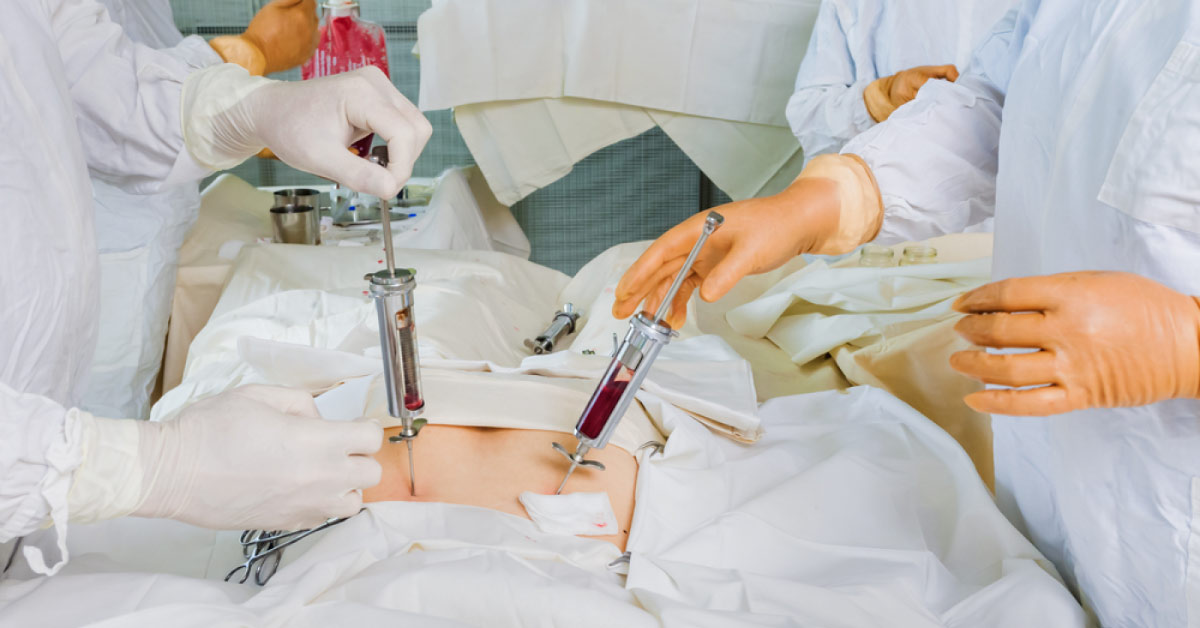 Bone Marrow Transplant: Frequently Asked Questions