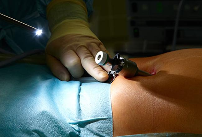 Intra-abdominal Pressure In Laparoscopic Surgeries For Obese, Morbidly Obese And Super Obese