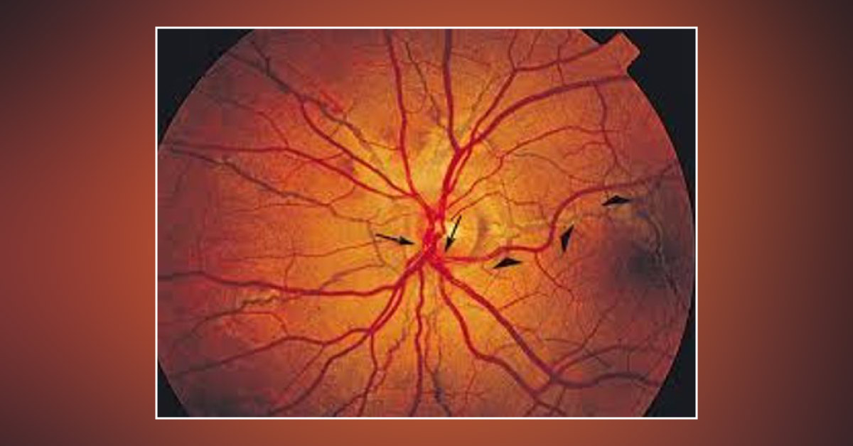 Spot the Ophthalmic Condition