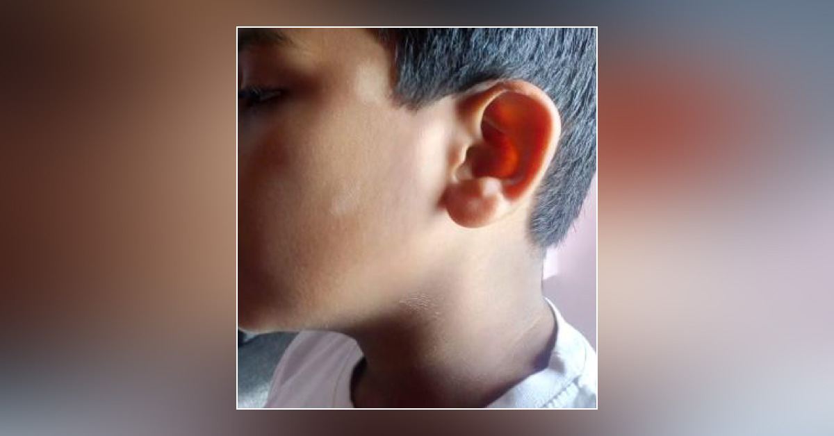 Diagnosis Of The Skin Lesion And Treatment