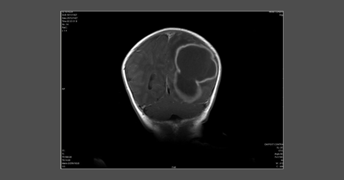 Diagnose This Case In An Infant