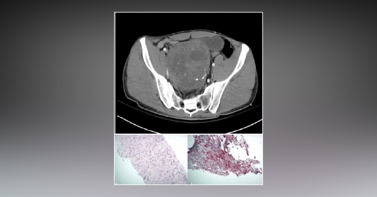 Diagnose This Incidental Finding in a Road Accident Patient