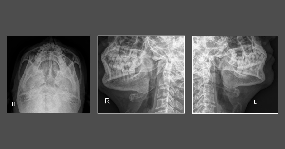 Spot The Abnormality?
