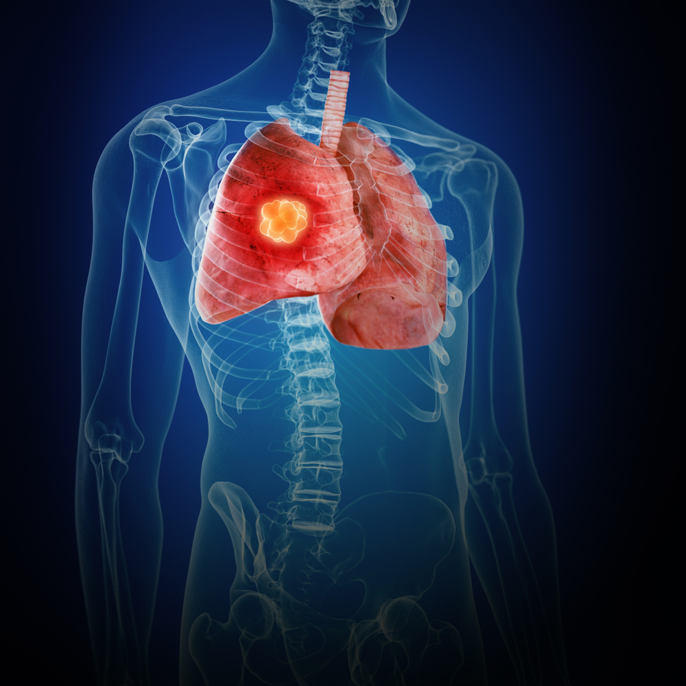 Evaluation Of The Airway 