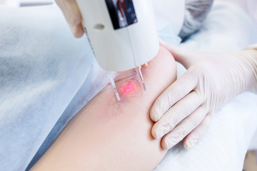 Brief Review On Laser Complications