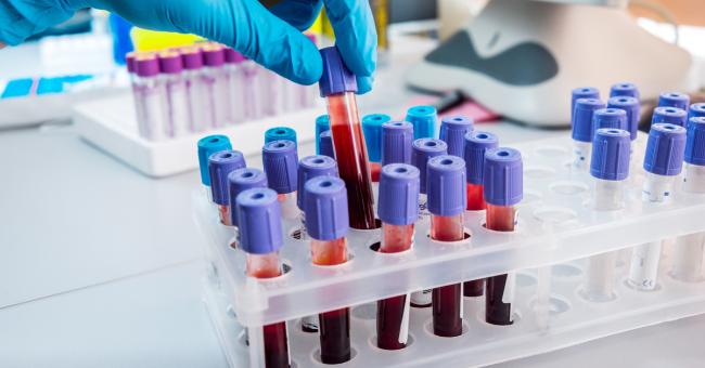 WHO Publishes List Of Essential Diagnostic Tests Should Be Present In Primary Healthcare