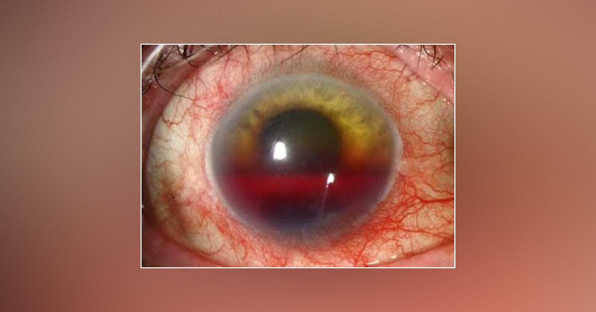 Diagnose This Ophthalmic Condition