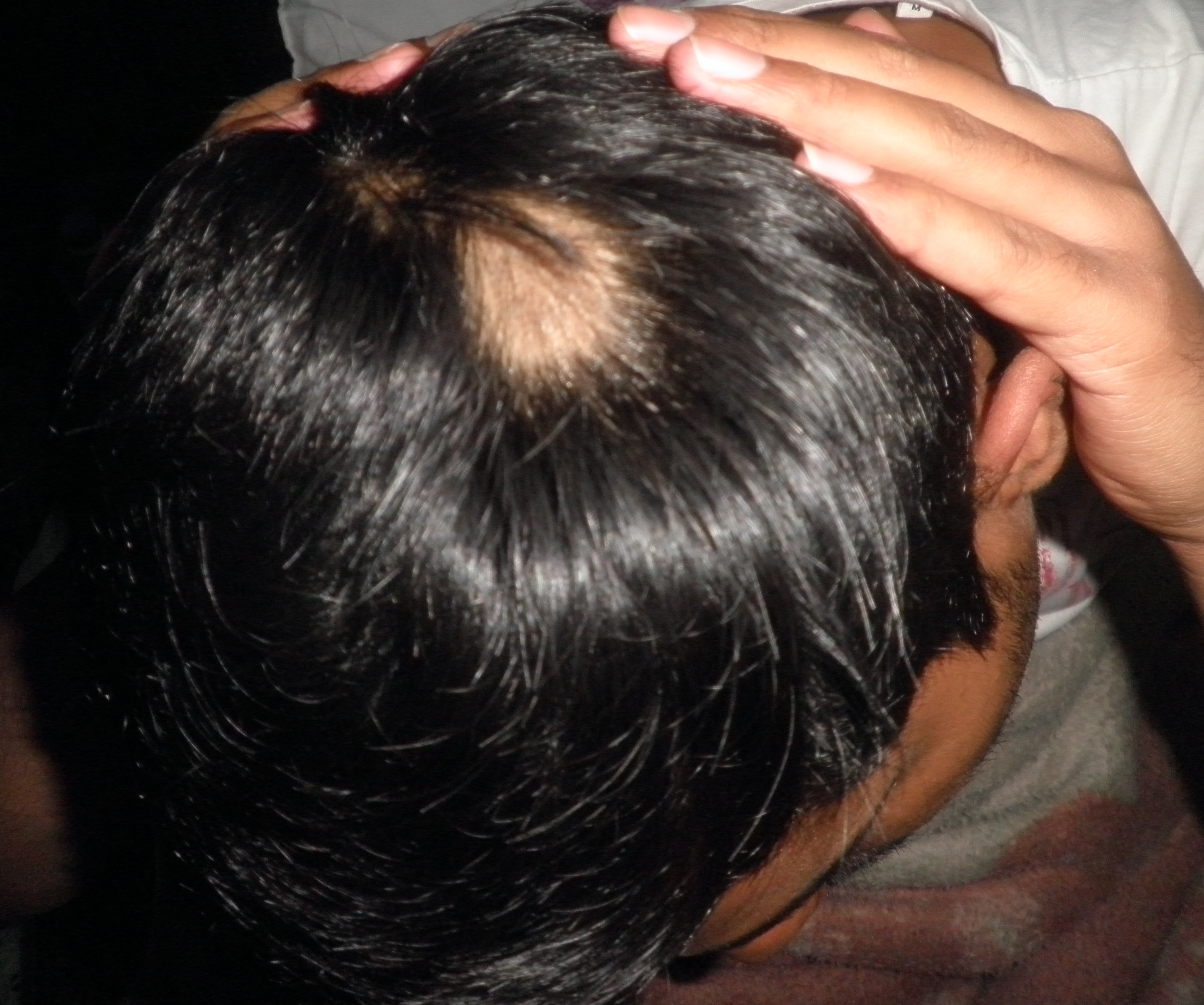 Spot The Diagnosis And Its Approach And Management