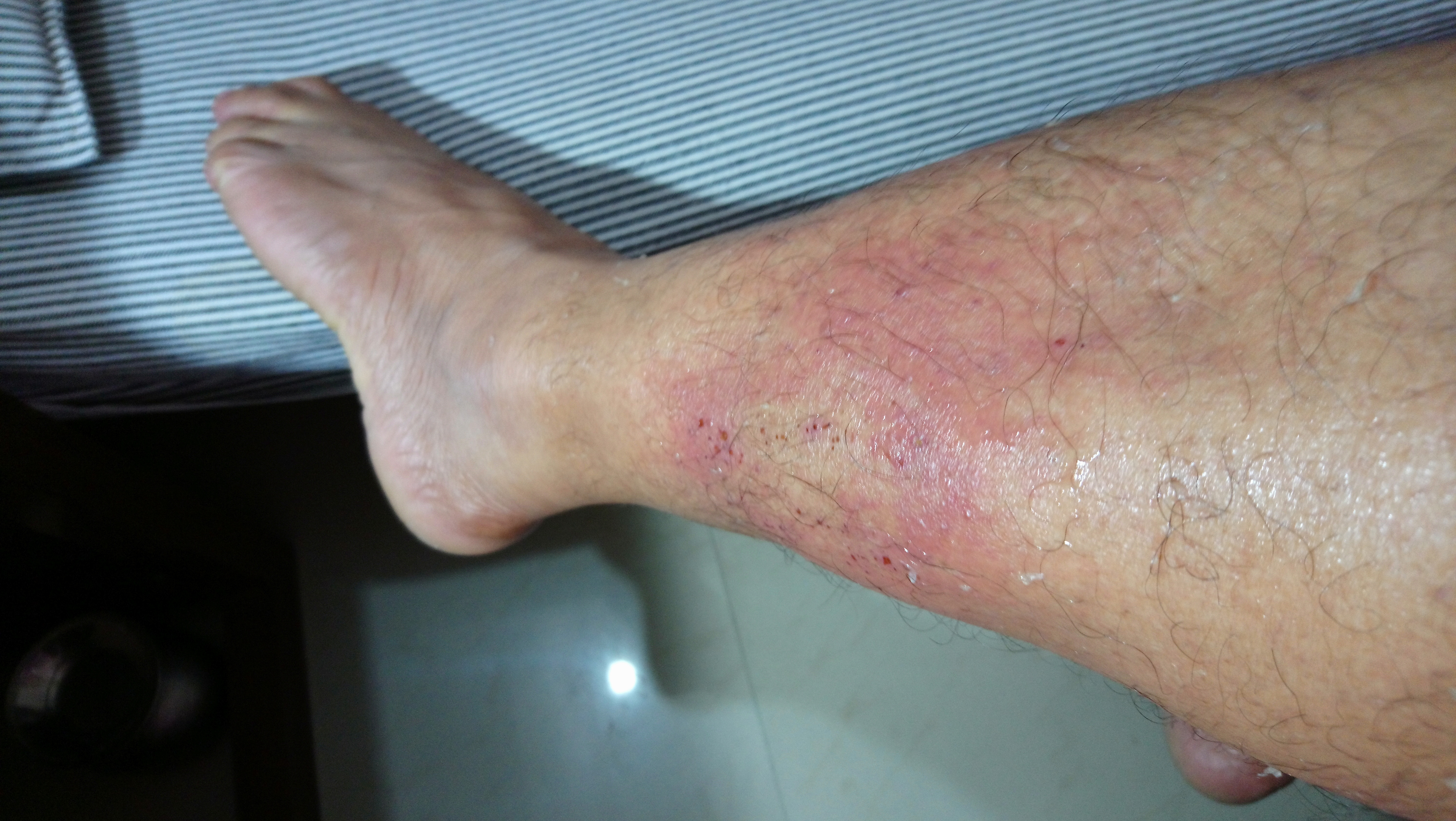 What Is The Spot Diagnosis