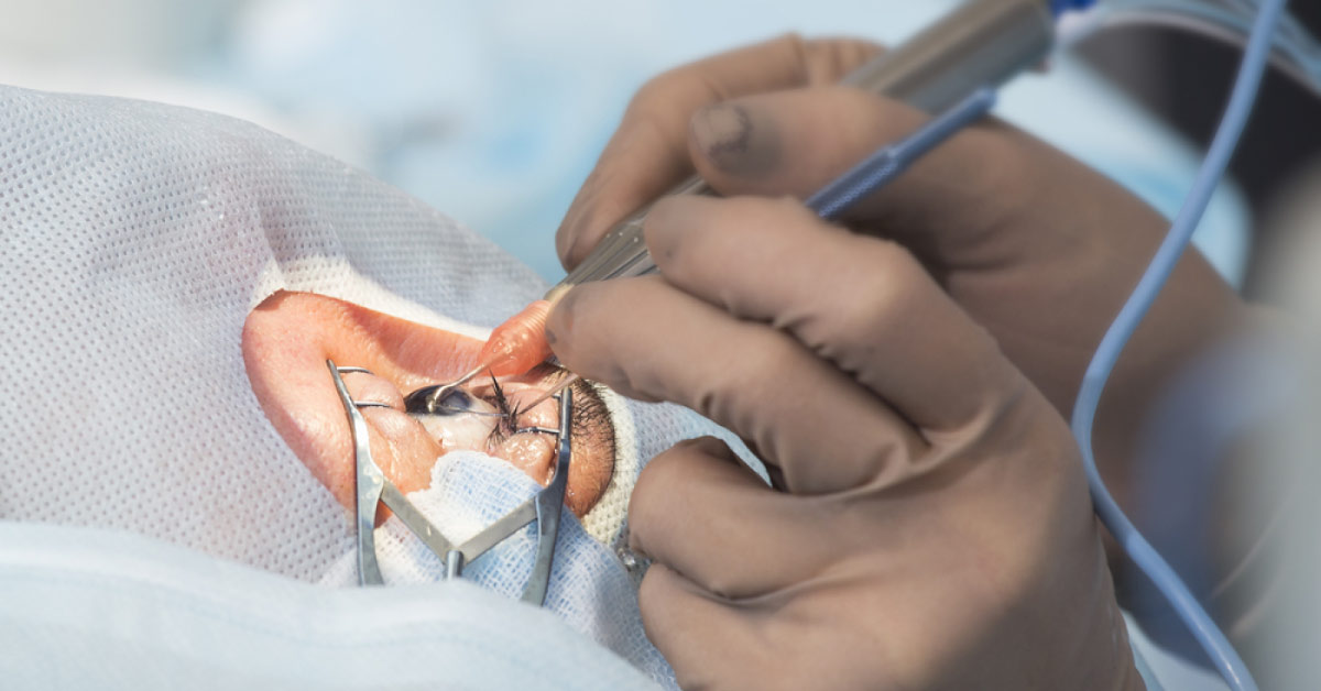 New Frontiers In Drug Delivery Innovation In Cataract Surgery