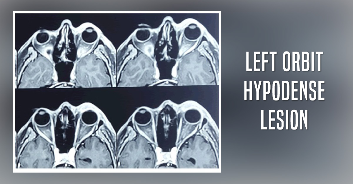 What Could Be the Differential Diagnoses for This Case?