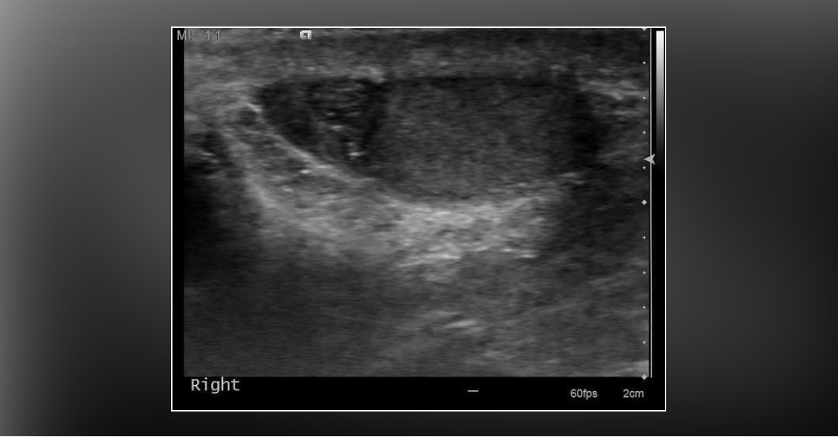 What Is Evident from This X-Ray?