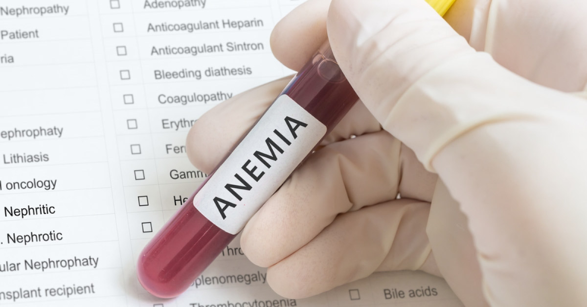 Management And Prognosis Of Fanconi Anemia