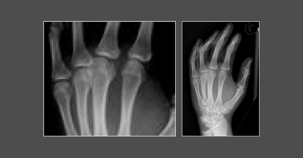 Diagnose This Orthopedic Case?