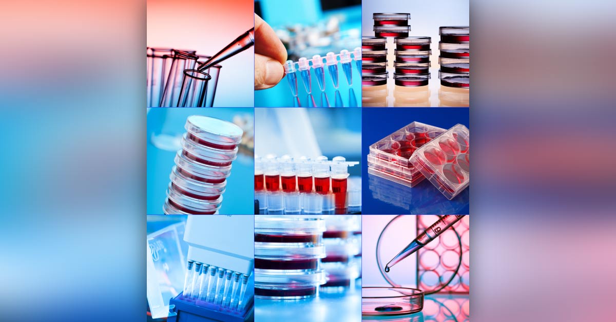 Molecular Tests V/S Conventional Microbiological Diagnosis Methods