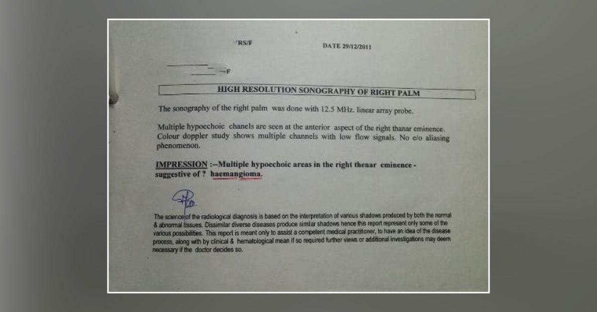What Is Treatment For Inter Digital Hemangioma For 15 Year Child