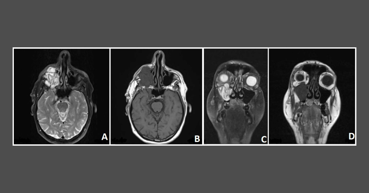 Can you Identify this Condition?
