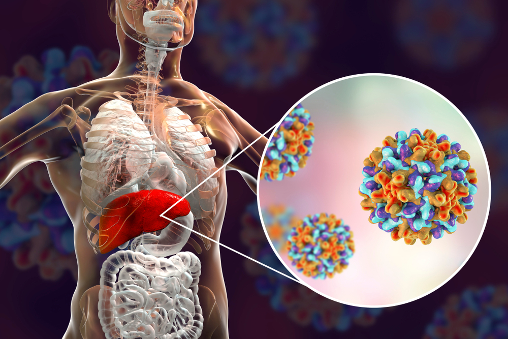 Preoperative Evaluation Of Hepatitis (Viral, Drug Induced, Exposure To Hepatotoxin)