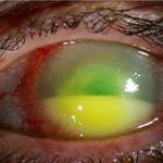 Spot the Ophthalmic Condition