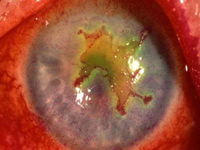 Spot The Diagnosis