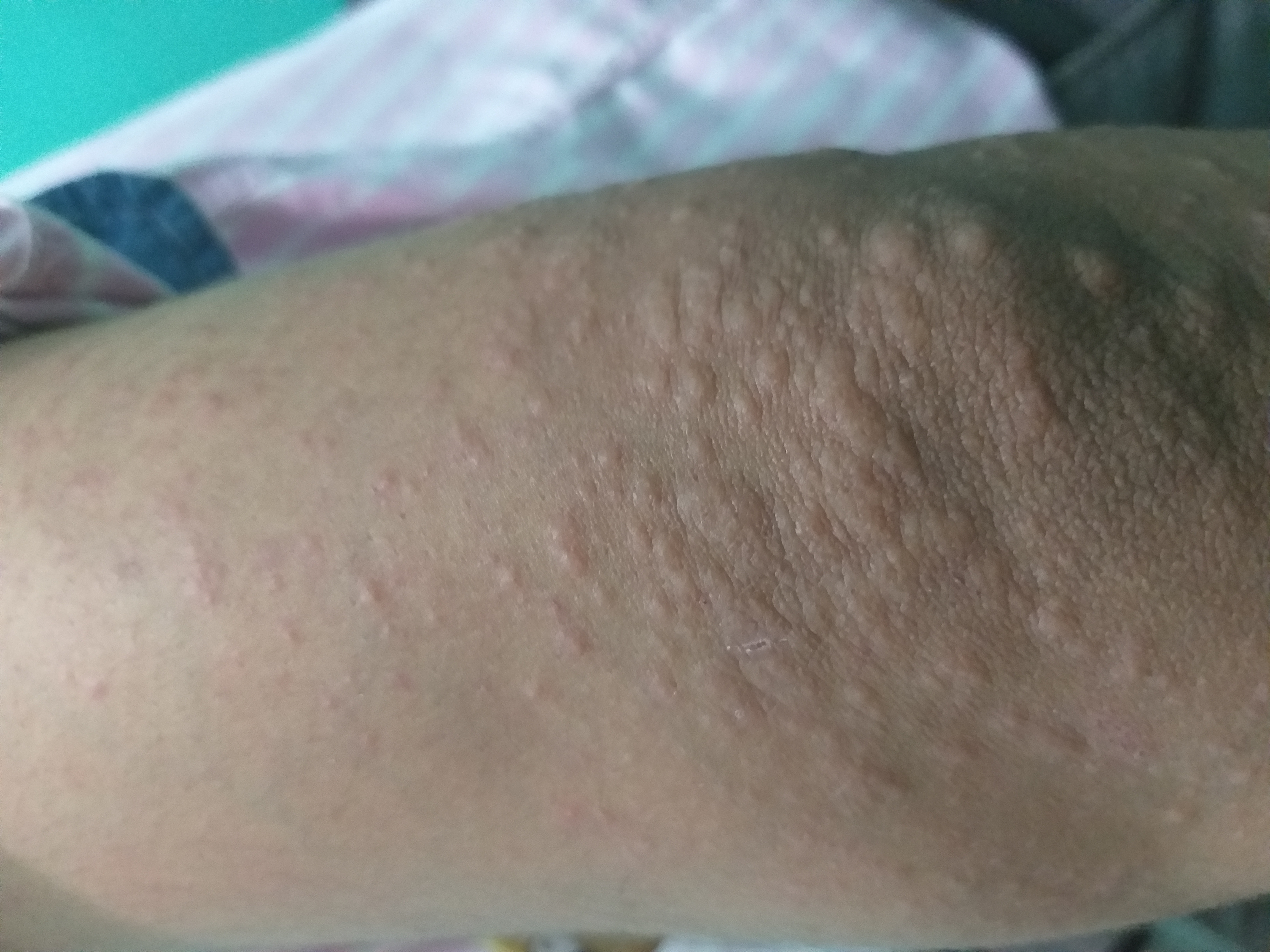What Could Be Possible Diagnosis