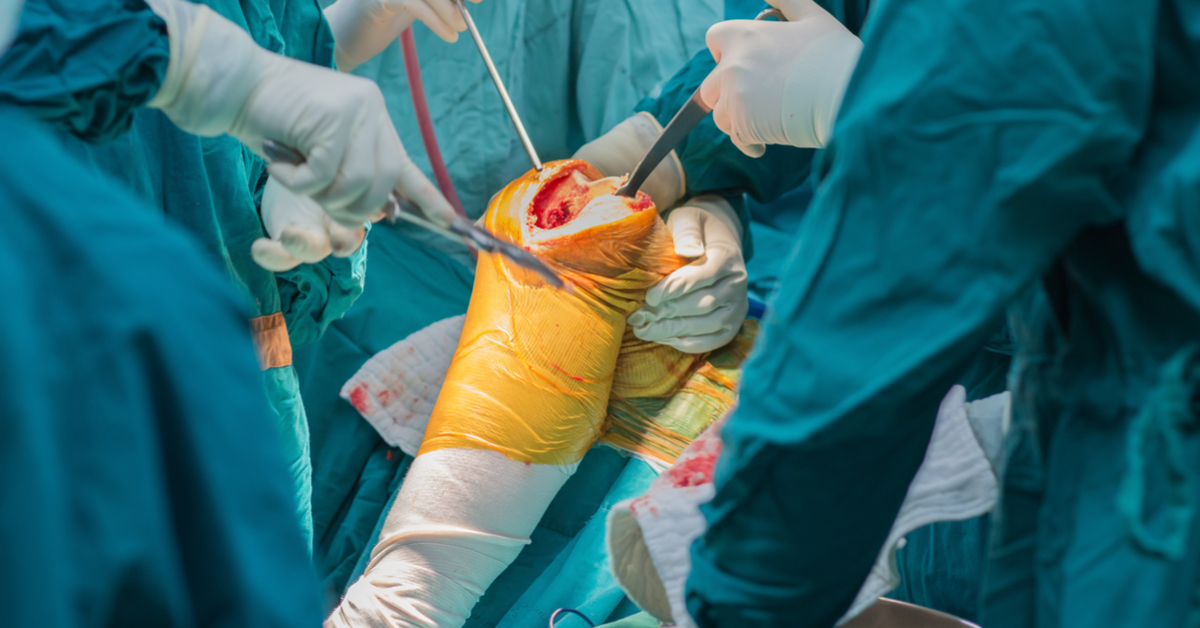 Use Of Cement In Replacement Surgeries