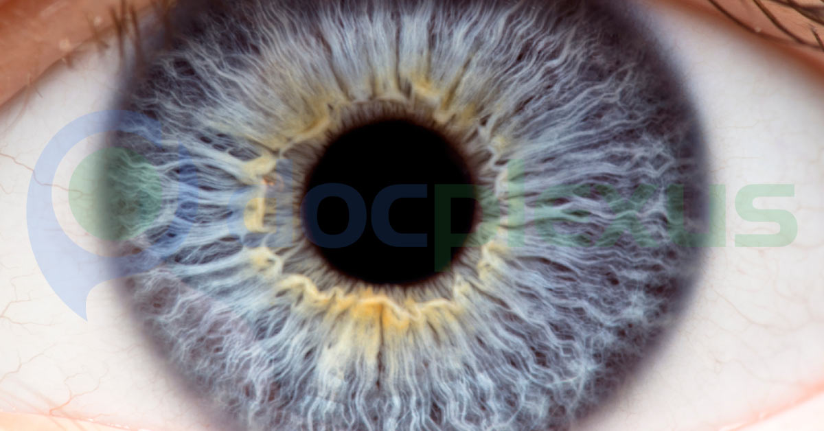 Brief Review On Visible Corneal Or Enlarged Corneal Nerves