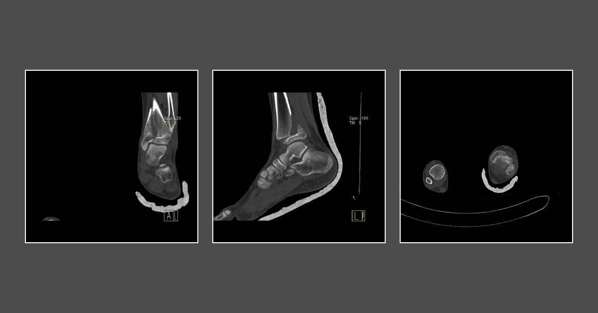 Spot The Diagnosis