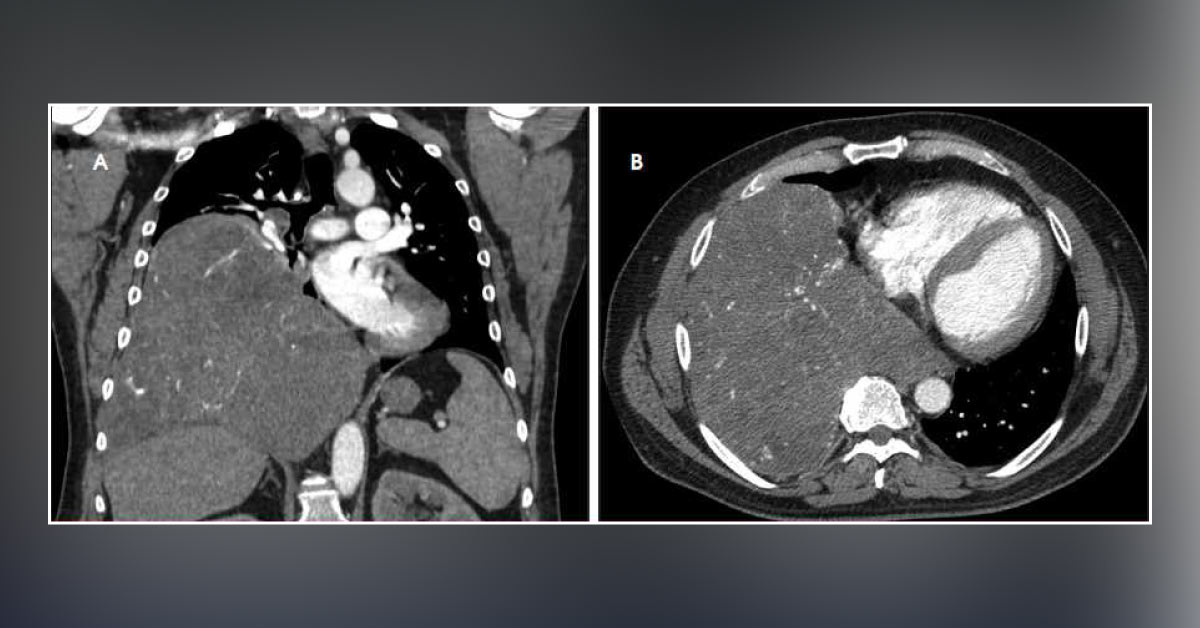 Diagnose This Patient's Condition