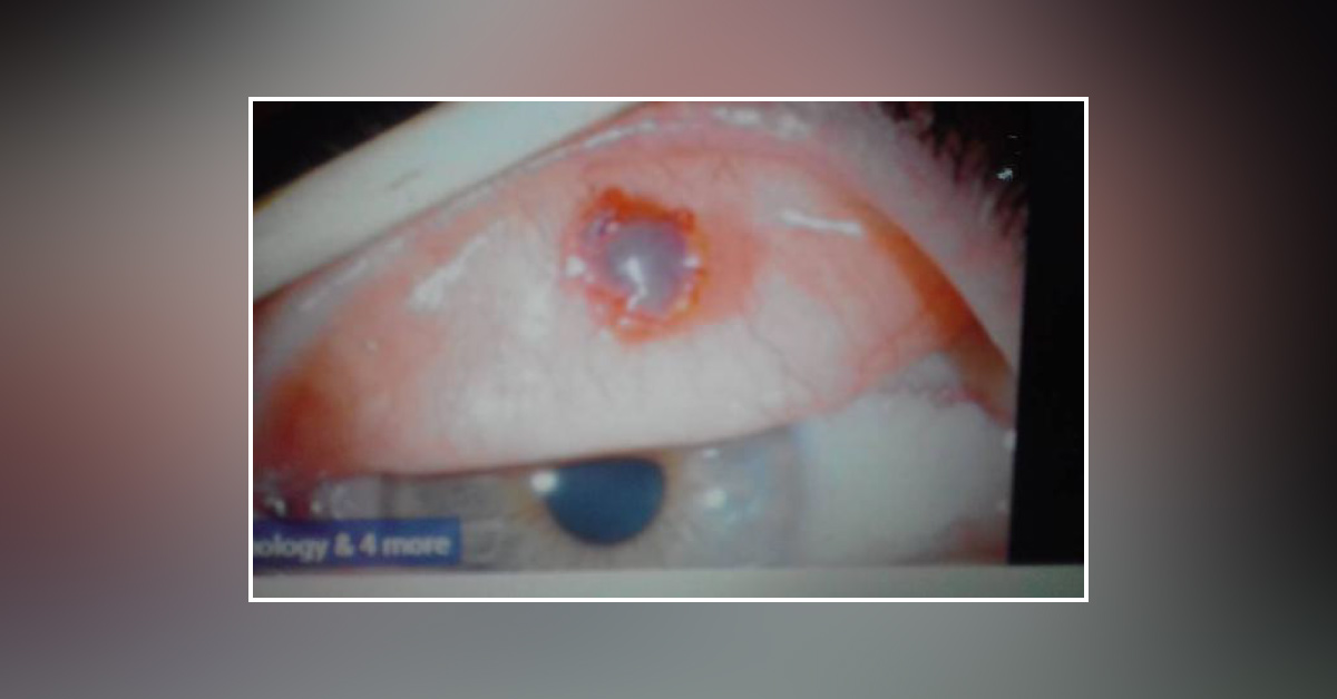 Spot the Ophthalmic Condition