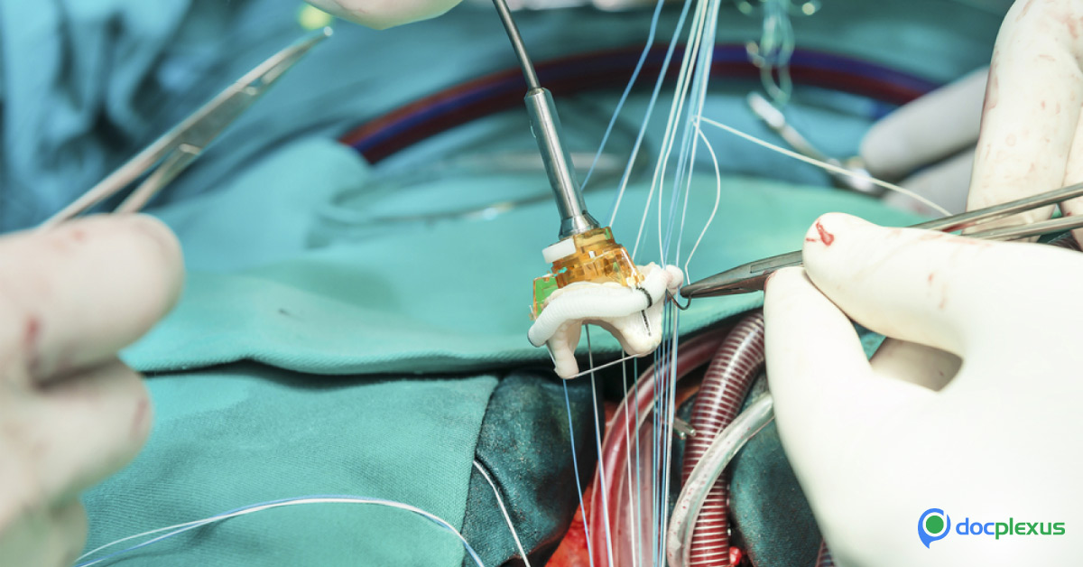 Reviewing Artificial Hearts (LVAD'S)