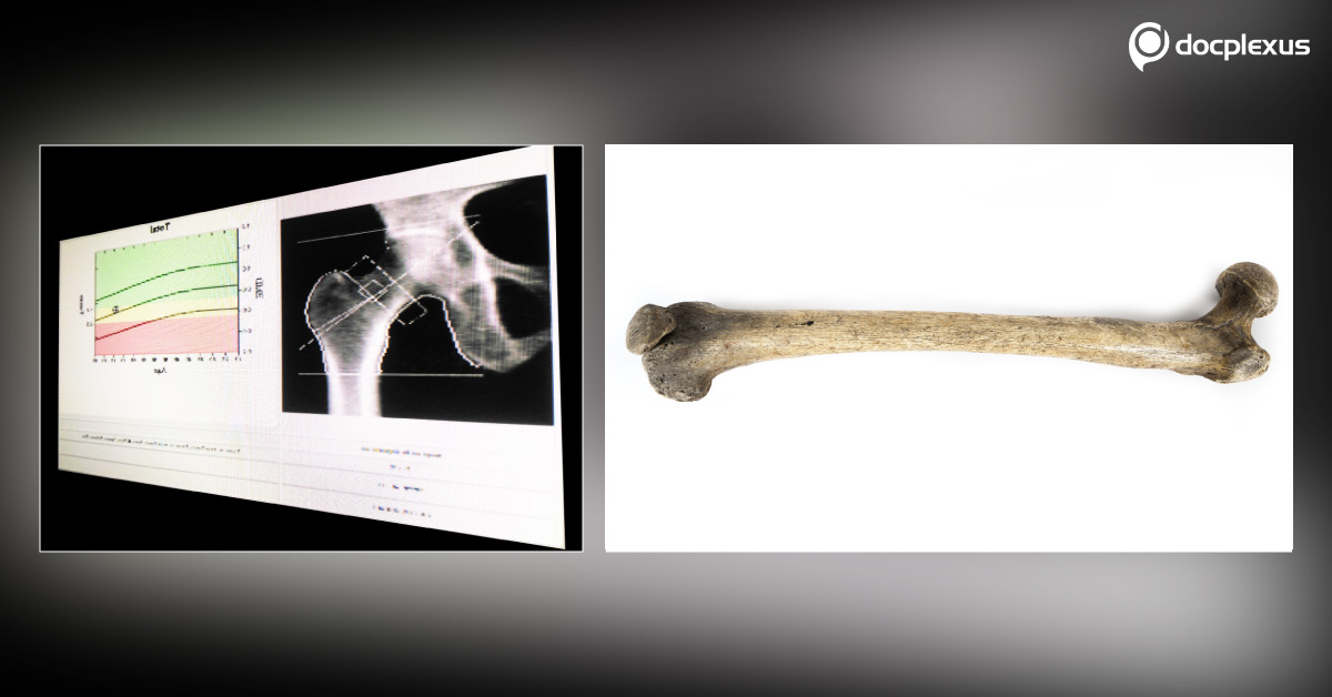 A New Method To Estimate Age Of Deceased
