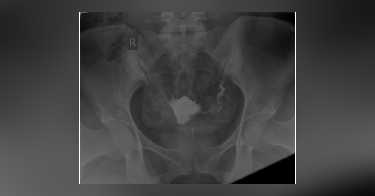 Diagnose This Case