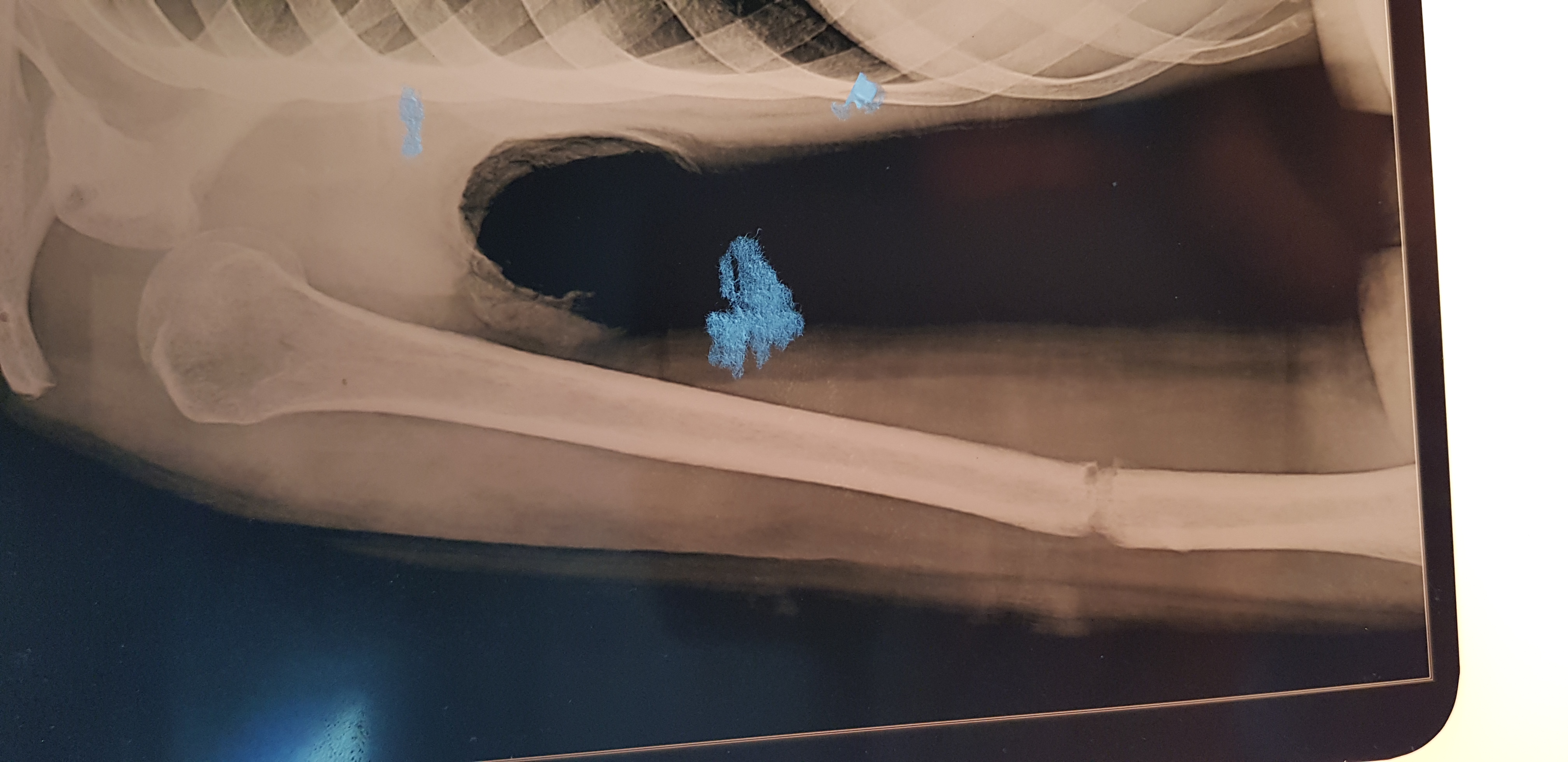 Discuss The Management Of This Arm Injury