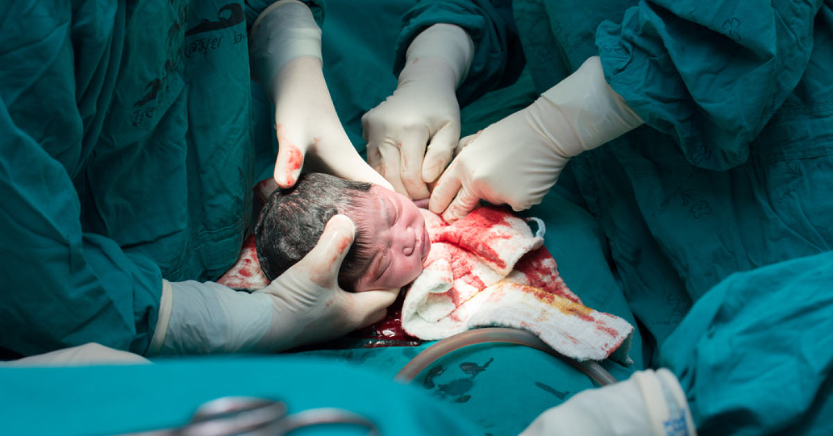 Use Of Caesarean Sections Doubled In India Between 2005 And 2015: Lancet